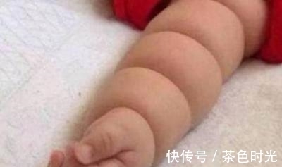 宝妈|妈妈发现宝宝身上长一圈圈的,不知是啥,医生检查后母亲却大哭!