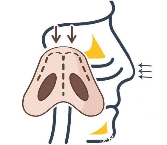 粘膜|癌症竟然是“抠”出来的？医生说出实话，希望你早改才好！