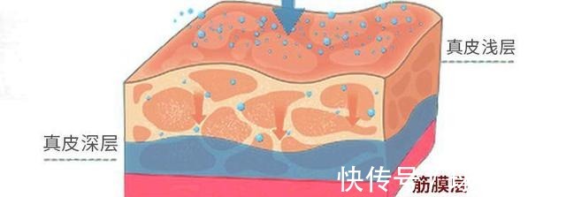 大拉皮 王小民教授做小拉皮的人逐渐增多,网上传言却没有效果!