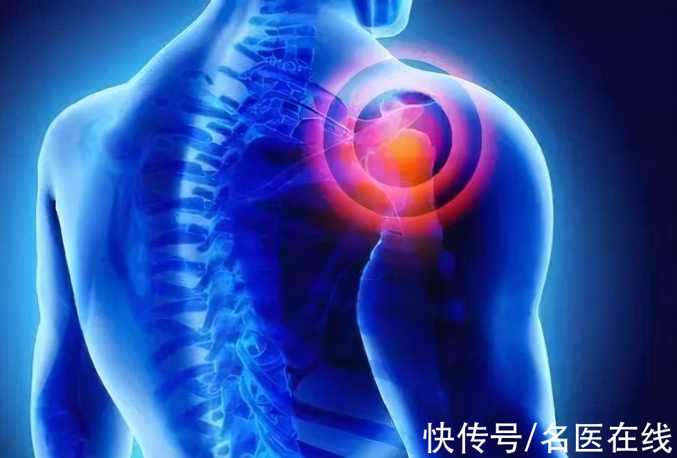 肩周炎|肩周炎到底是怎么回事？三分钟解析清楚