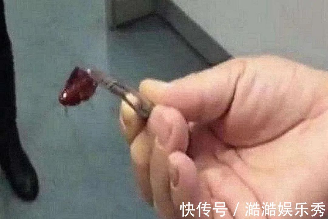 听力|娃耳朵进虫子,妈妈果断地处理方式救了孩子的听力,连医生都夸赞