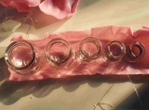 治病|拔罐能祛寒排毒?民间盛行的养生拔罐,究竟是治病还是有害健康?