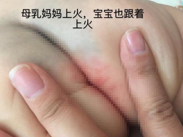 清洗|宝宝拉完“臭臭”之后,应该选择温水清洗还是用纸巾擦学问很多