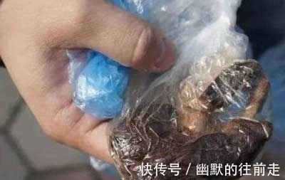 女子|剖腹产生下儿子后,腹部剧痛难忍,医生再次打开肚子,吓得傻了眼