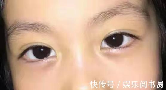 脾衰|8岁女童从积食拖成脾衰,孩子有3种迹象,脾胃或早已“不堪重负”