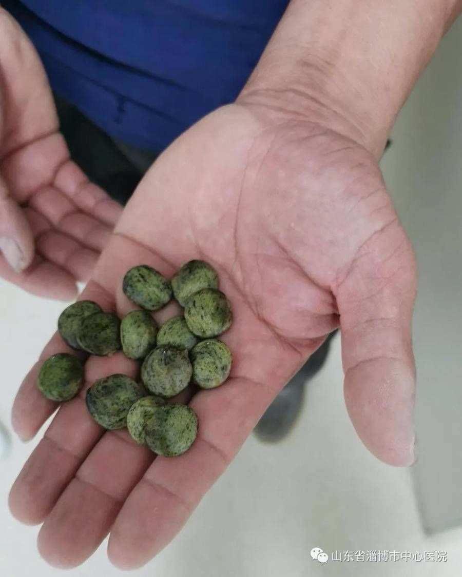 豆荚|路边常见“紫藤”含剧毒！儿童误食致中毒，医院紧急抢救