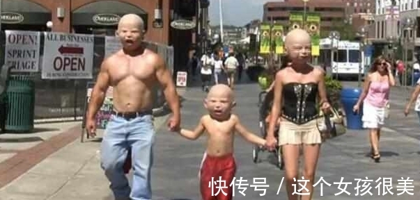 基因变异|一家三口相貌变成巨婴,是基因变异还是逆龄生长,原来是这个原因