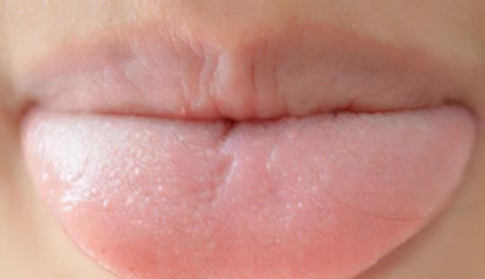  细菌|那些晨起不刷牙就喝水的人，现在发生了什么变化？早知早好！