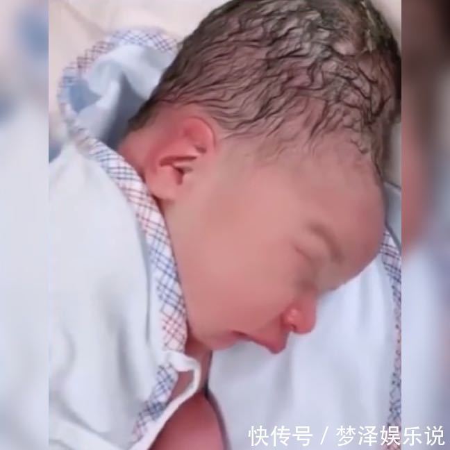 头骨|产妇分娩时不懂正确用力,婴儿头部被严重挤压,网友:很像寿星公