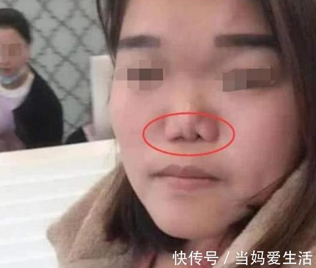 坏习惯|从小“挖鼻孔”和“从不挖”的娃, 长大啥区别? 父母别不当回事