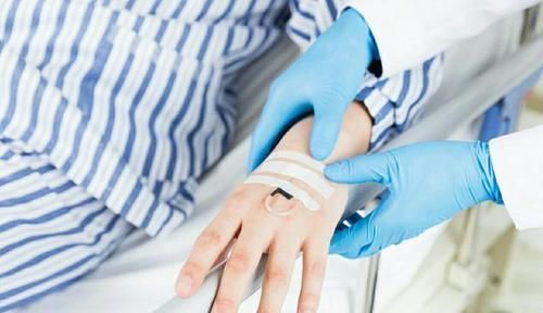 复发|有些肠癌术后无需化疗,真的吗?Ⅱ期结肠癌要不要化疗最“复杂”