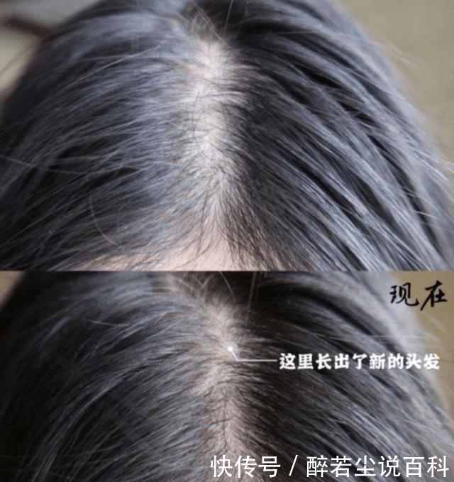 有光泽|继“蜂花”后！国内又一洗发水受大众“宠爱”，控油养发很温和