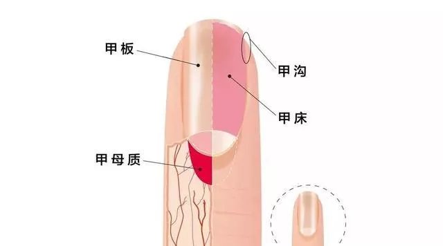 指甲剪短点才干净？小心，越短越容易患这种病！