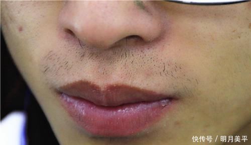 肺部|为何鼻毛总是“冒”出鼻外,说明了什么?能不能直接拔掉?