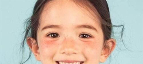 为什么女性脸上容易长斑点？找到原因了，3种办法让自己慢慢变美