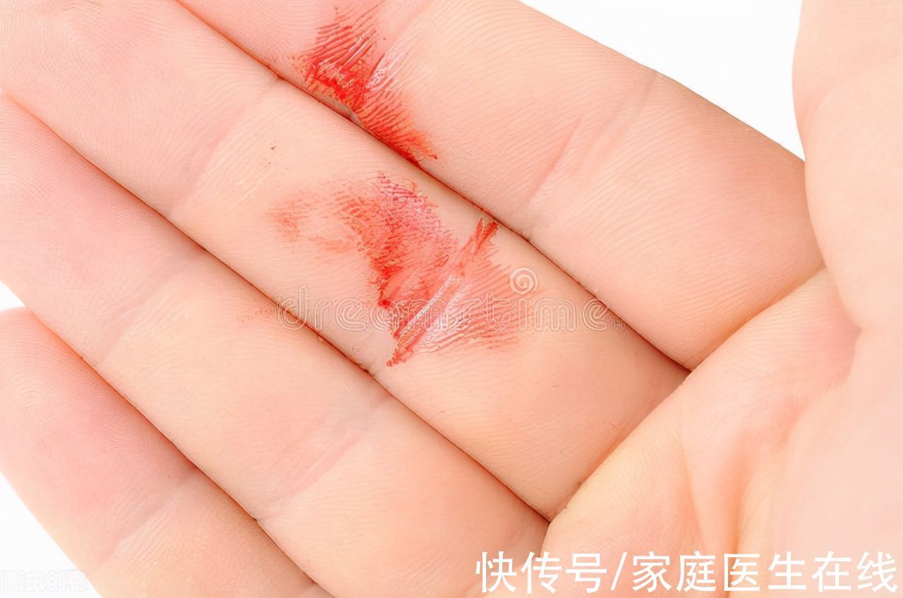 不明原因|癌症早期没有任何症状?其实不然,身体出现这4种症状,提高警惕