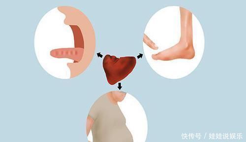 脾一虚,人废一半脾虚湿气重教你调理方法,轻松补脾赶跑湿气