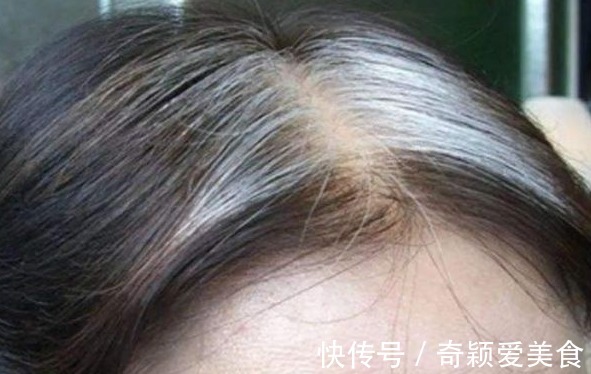 健康|长白头发,对我们健康来说是一件好事吗?听听哈佛大学研究怎么说