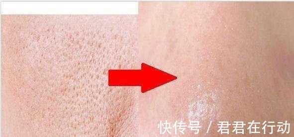 区别|“坚持美白”和“坚持补水”，10年后有什么区别原来差距这么大！