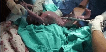 宫口|顺产到底有多疼，给你们看完这18图片，就能真正理解女人不容易