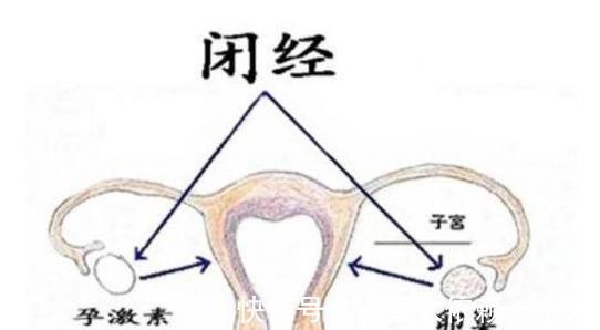 子宫萎缩|上环的女人，到了此年龄，节育器就要取下来，不然子宫会受伤害