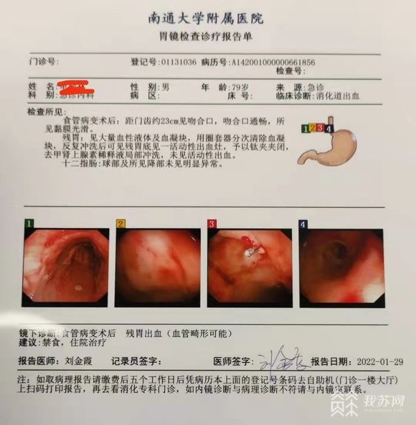 刘金霞|10年上消化道出血6次，通大附院查出罕见病因