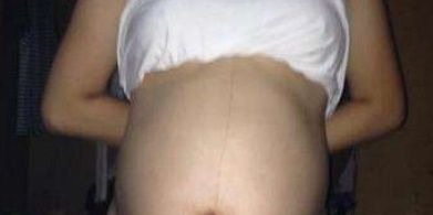 儿科医生|生男生女?可以从孕肚上的一条神秘“黑线”看出?答案让人暖心