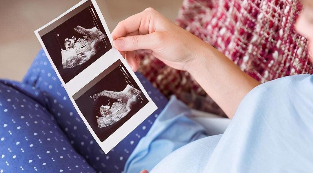 宝宝|孕妈出现这3种反应,这是胎宝宝在喊饿了,孕期要多注意