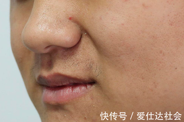 补充|男性若是睾酮不足,身体会表现出哪些“丑态”如何补补多少