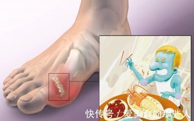 尿酸|“高嘌呤”食物榜单已列出:海鲜排末尾,榜首很多人却当成补品