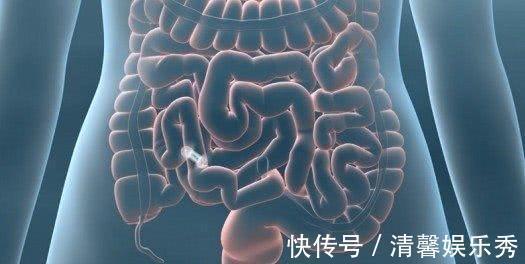 肛门|50岁后,长期“便秘”的人会患大肠癌?告诉你真正检查的办法