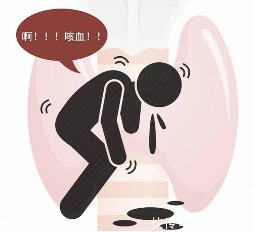 癌变|肺癌一发现就是晚期?早期3个信号并不难发现,可惜很多人不懂