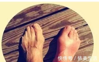 豆类|痛风能吃豆角吗?不仅能吃,还要多吃,因为她对痛风有这些帮助