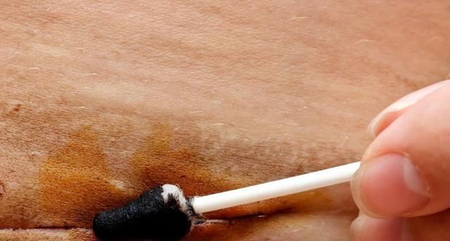 外科手术|剖腹产时,伤口缝线处理是用美容线好还是拆线的好?