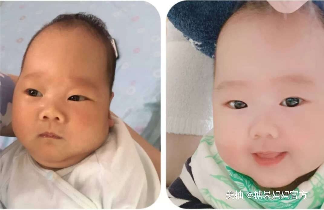 逆袭|新生儿这几个部位丑,反而预示高颜值,宝宝逆袭的我你高攀不起