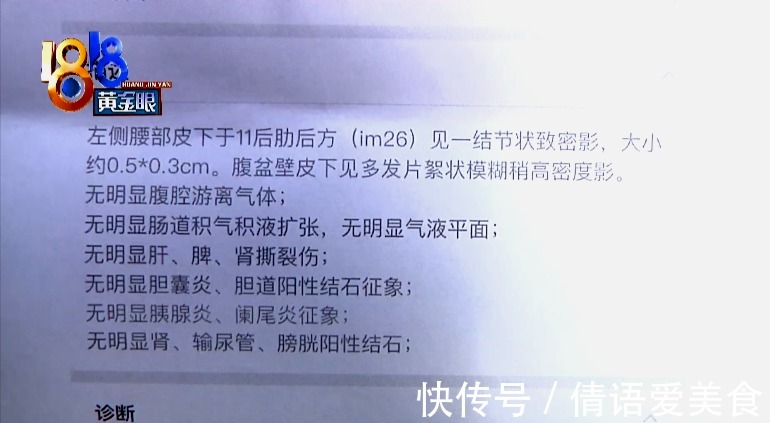 探头 吸脂术探头留在姑娘体内,院方两次手术都没取出