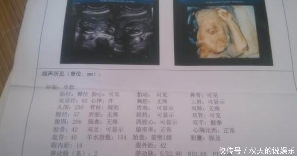 孕期|孕期产检时,是选择“B超”好还是“彩超”好?医生这样建议