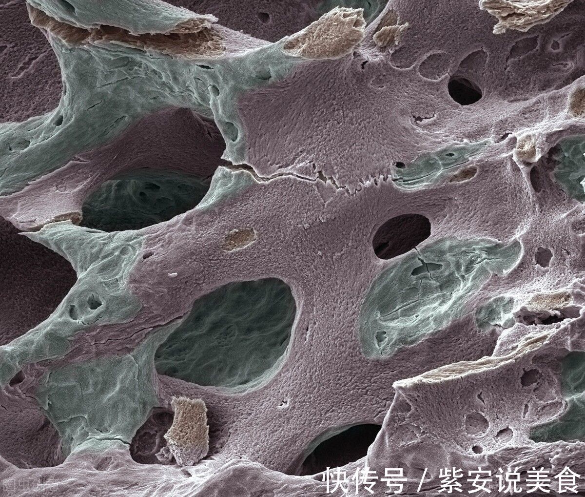 骨质疏松|88岁中科院院士:骨骼“喜爱”3种食物,若你喜欢,不妨多吃点