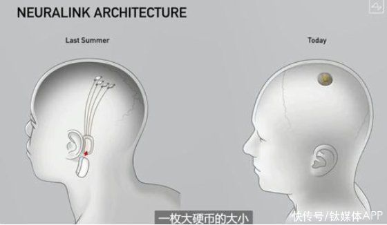 接口|所想即所得——脑机接口发展前景：跨维沟通或成现实？