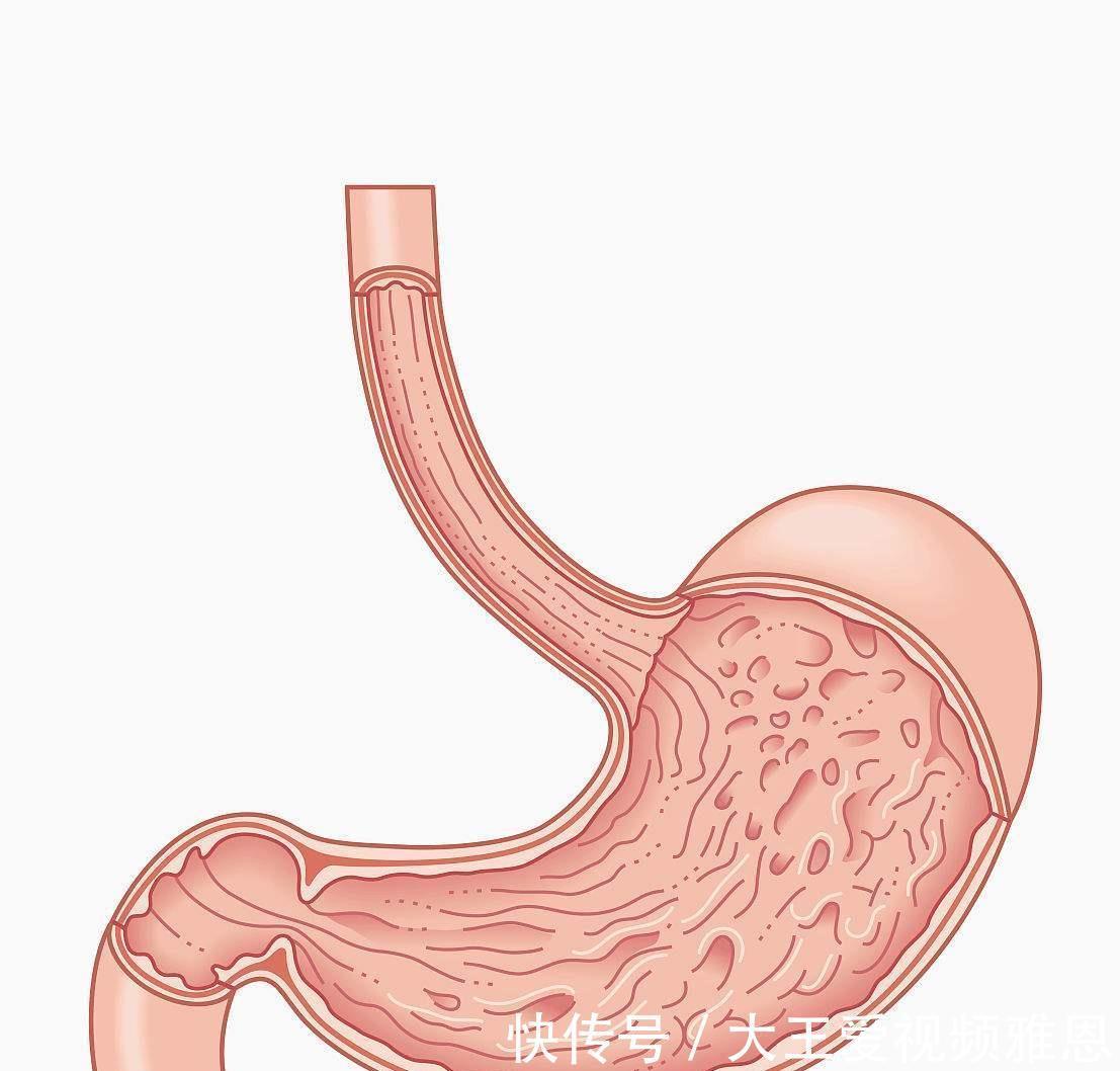 常吃|胃不好怎么办5种水果常吃，或有助缓解肠胃不适
