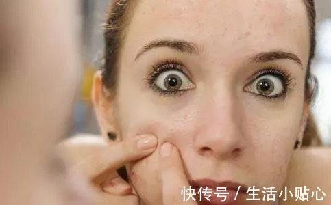 修复|每次换季都“眼红红脸红红”，如何才能不当敏感肌大红人？