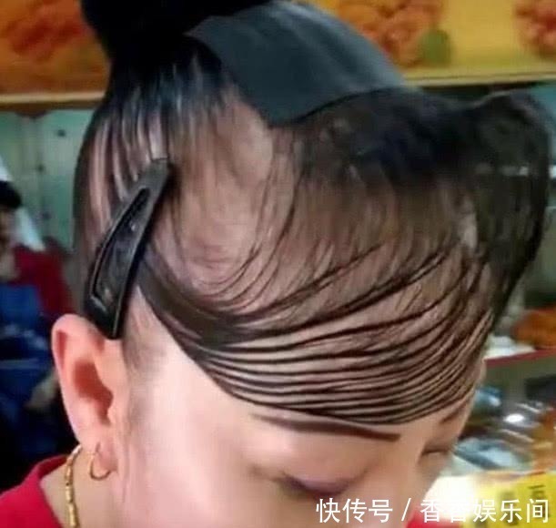 大妈花4万多植发,新发型让人哭笑不得,网友:还是戴假发吧!