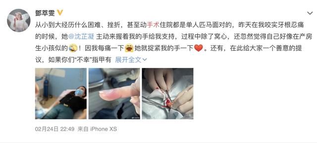 维生素|「长倒刺」的真正原因多数人不知道,简单3步无痛除倒刺