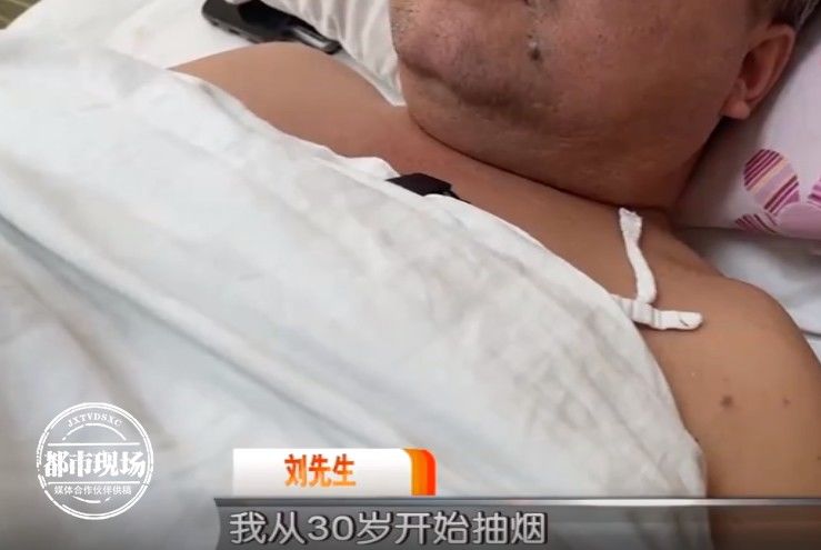 脚趾|男子3个脚趾全都变黑坏死，快停止这个习惯