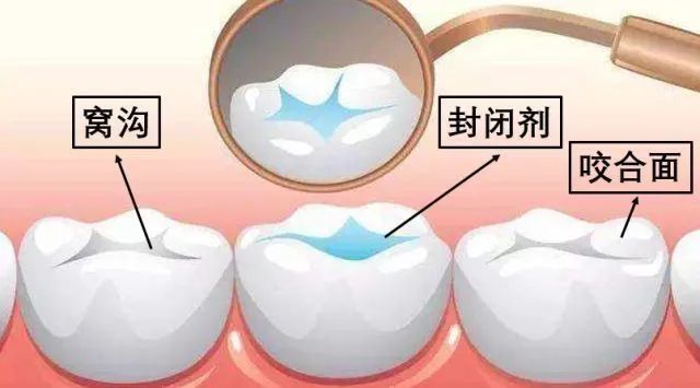 知识|家长必看！儿童口腔健康核心信息及知识要点