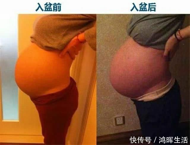 宫颈|怀孕晚期肚子隐隐作痛,说明胎儿入盆了马上要生了吗