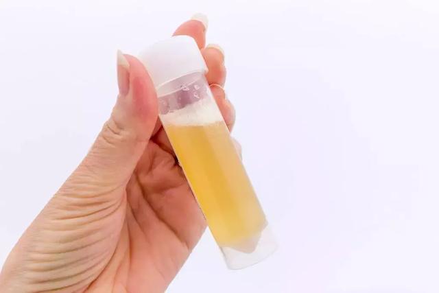 夜尿|睡觉时身体有4种表现，是肾在喊“救命”！不注意，会熬成尿毒症