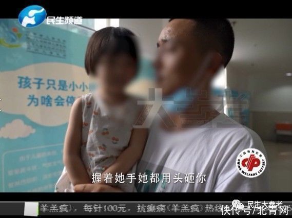 童童|这个感受不到疼痛的3岁小女孩,却让很多人心疼