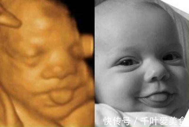 准爸爸|准妈妈在医院门外大哭,只因宝宝四维彩超太丑,网友:亲妈都嫌弃