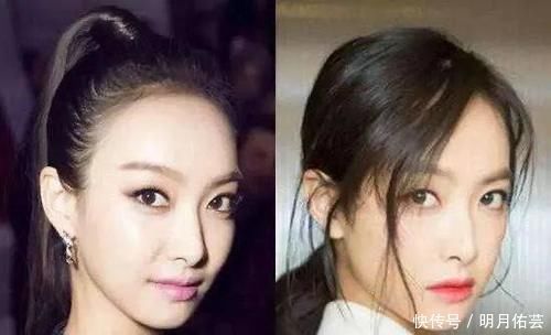 发型|发际线比较高的女生,尽量少梳这3种发型,否则发际线会上移!